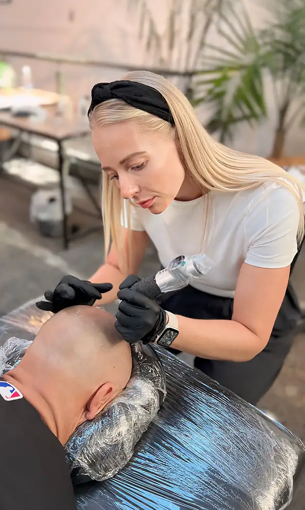 scalp micropigmentation nz